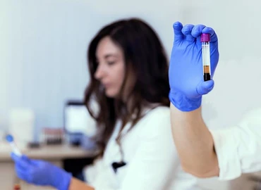 A PTE professzorának tanácsa: előzzük meg az érbetegségeket!